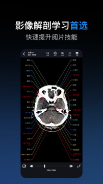 影像解剖图谱下载app v4.5.8