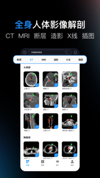影像解剖图谱下载app v4.5.8