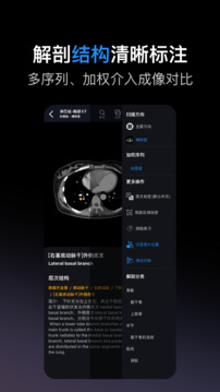 影像解剖图谱下载app v4.5.8