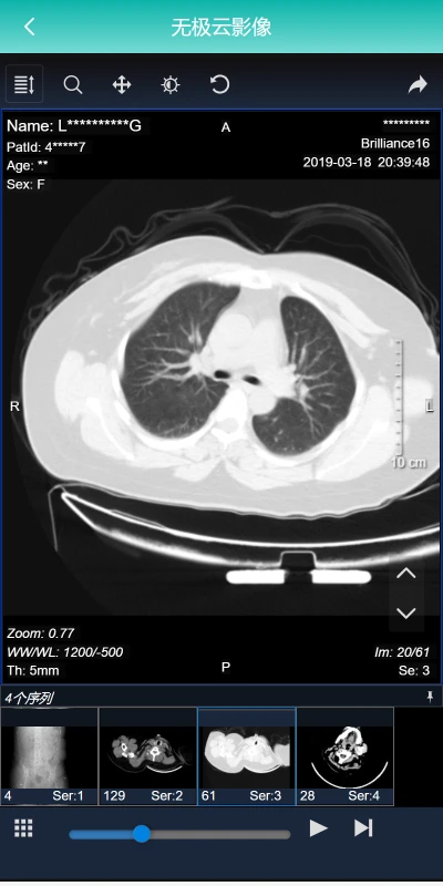 无极云影像app v1.0.5